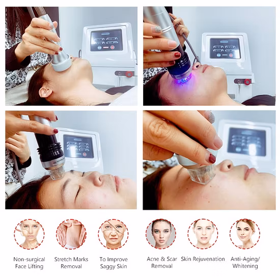 Micro aiguilletage Resserrement de la peau Élimination des rides et des vergetures RF Microneedling Fractional RF Microneedle Fractional RF Microneedle Machine Machine de beauté